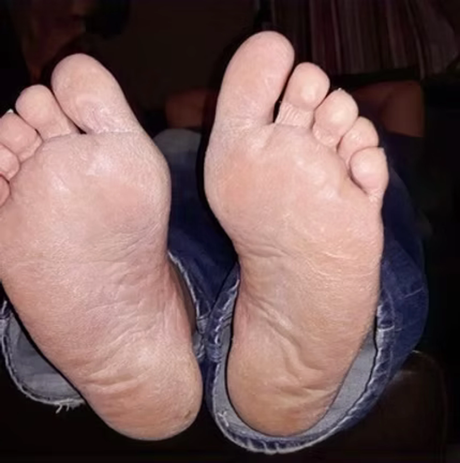 Wirtschaftsverein Apollon - Projektleitung von Konvaleszenz - Füße