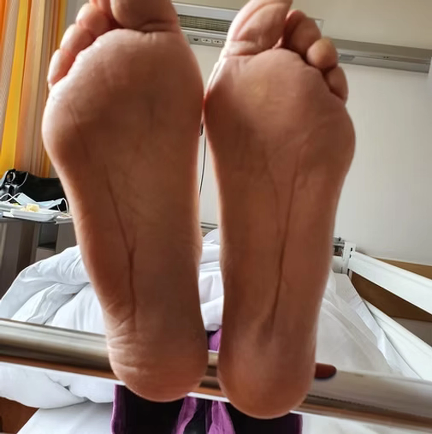 Wirtschaftsverein Apollon - Projektleitung von Konvaleszenz - Füße