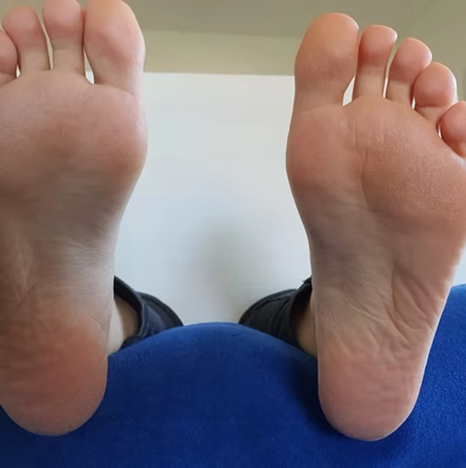 Wirtschaftsverein Apollon - Projektleitung von Konvaleszenz - Füße